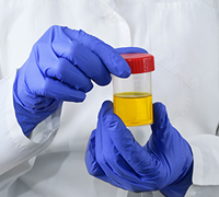 Laboratory doctor with a can of urine tests in their hands.